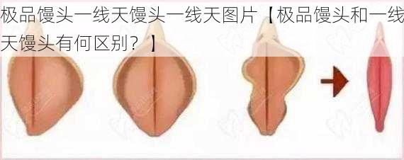 极品馒头一线天馒头一线天图片【极品馒头和一线天馒头有何区别？】